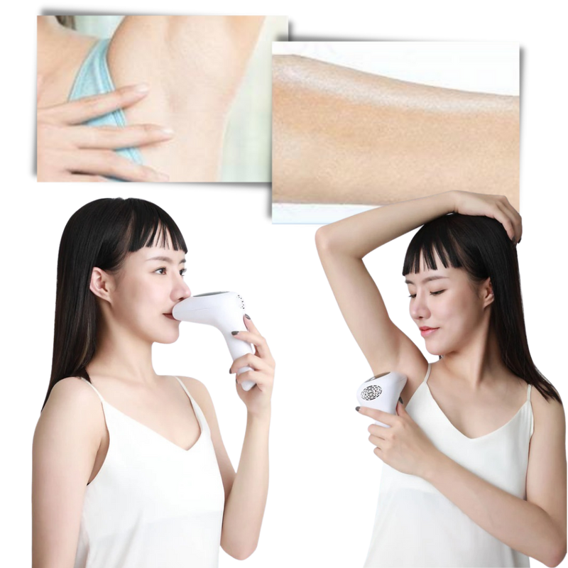 Appareil d'épilation laser IPL